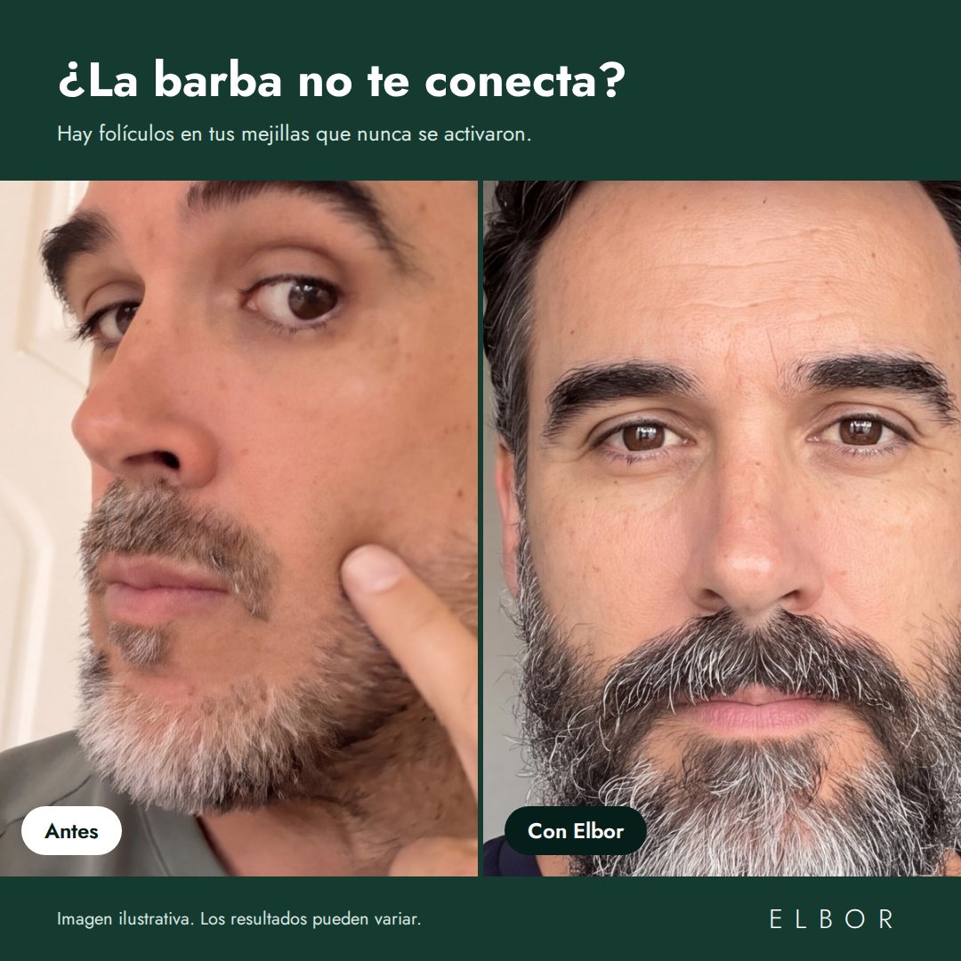 Barba antes y con Elbor, imagen ilustrativa